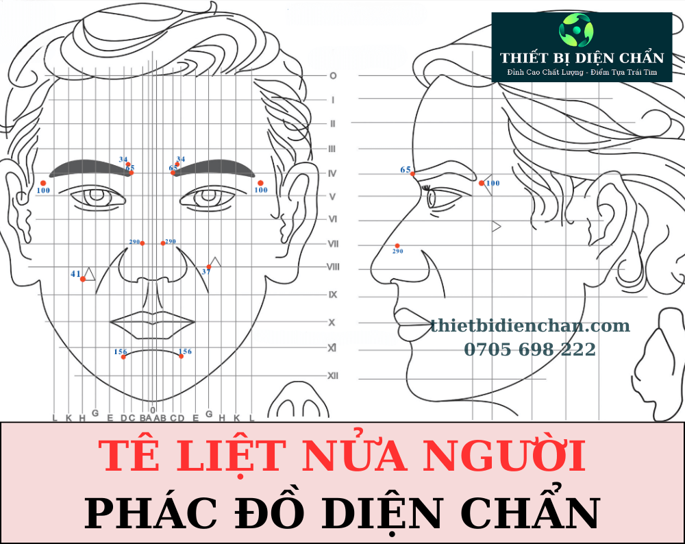 Tê liệt nửa người