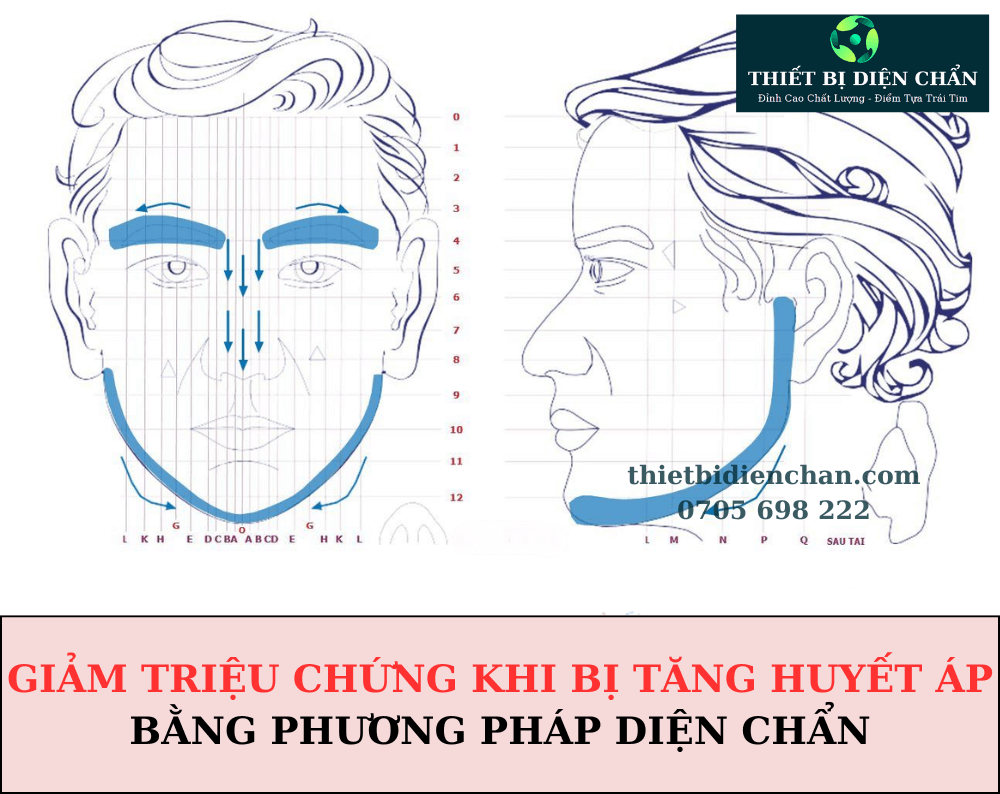 Huyết áp cao