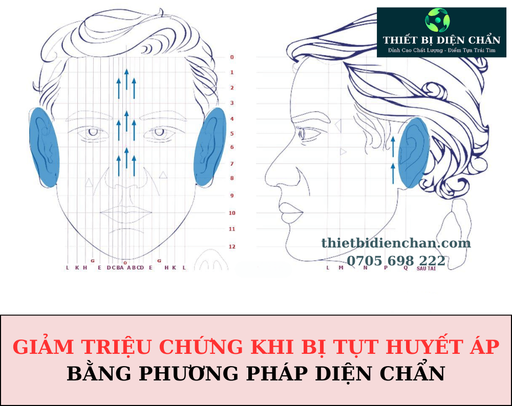 Huyết áp thấp