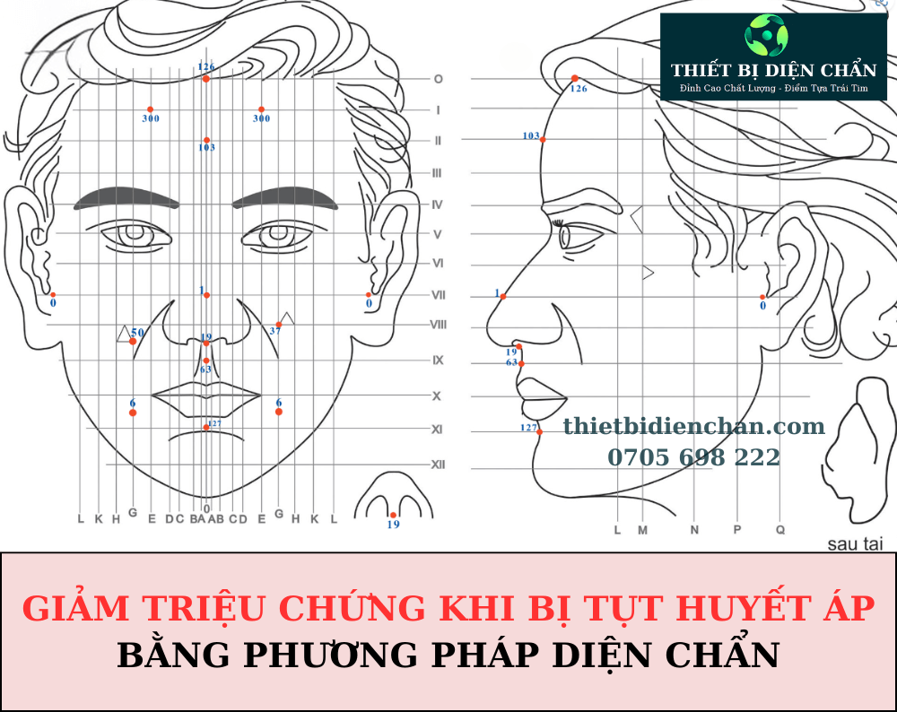 Huyết áp thấp