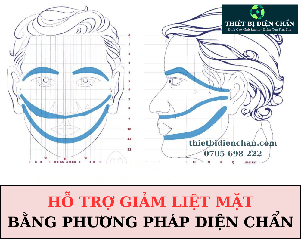 LIỆT MẶT