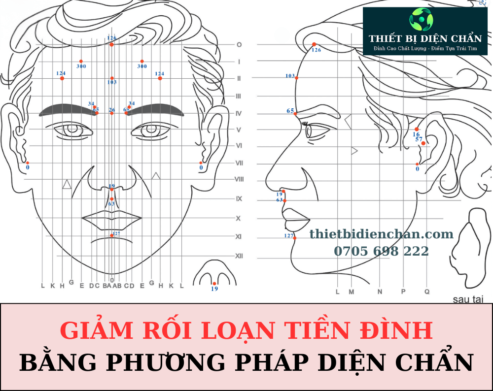 Rối loạn tiền đình