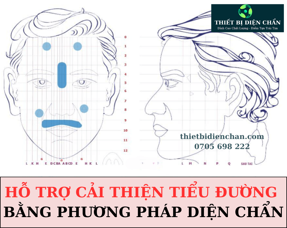 tiểu đường