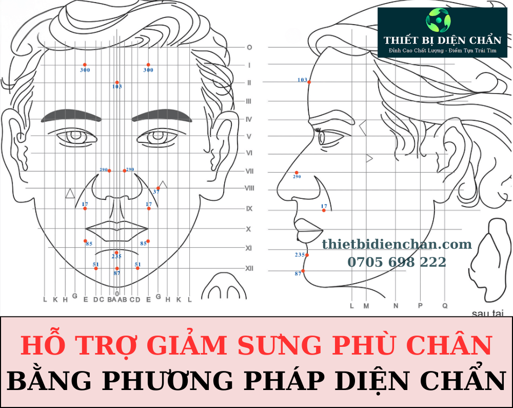 sưng phù chân