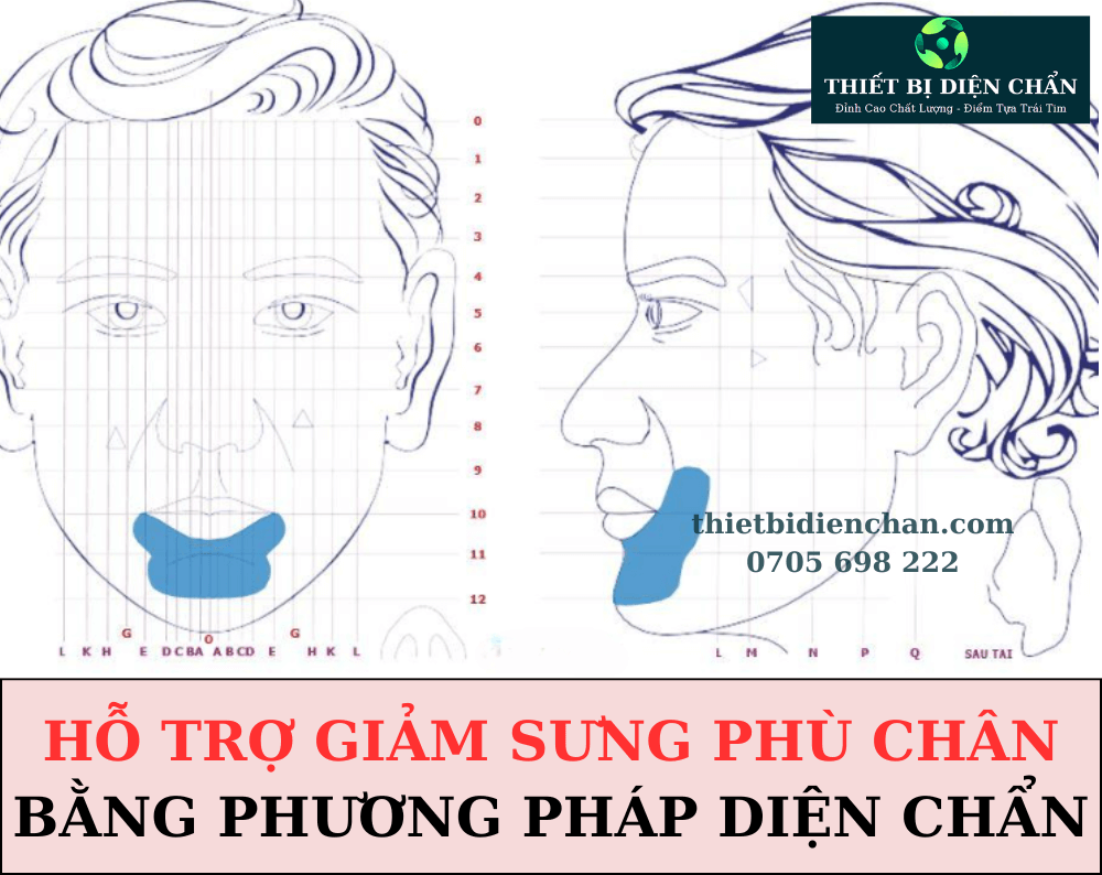 sưng phù chân