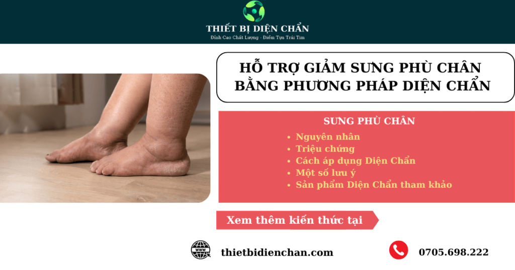 sưng phù chân
