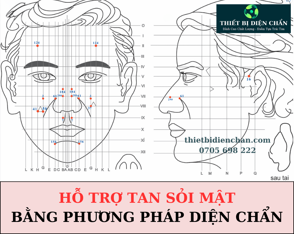 sỏi mật