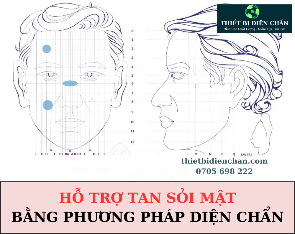 sỏi mật