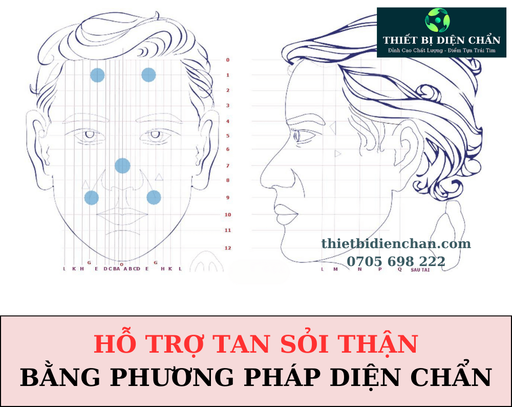 Sỏi thận