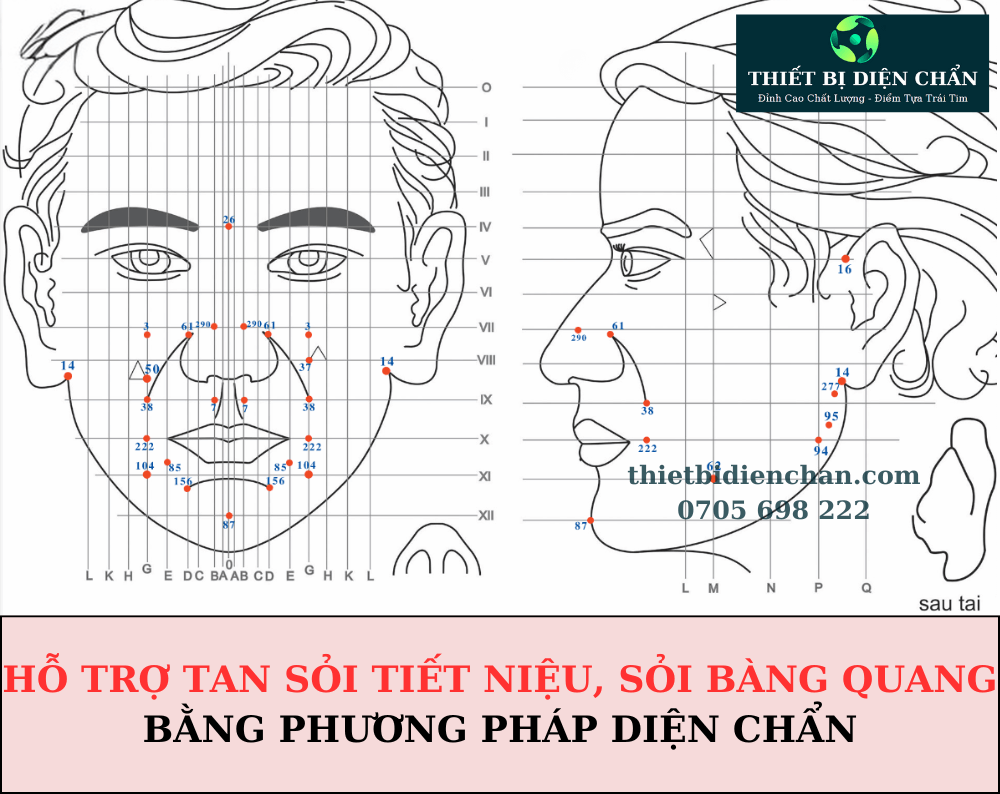 sỏi tiết niệu, sỏi bàng quang