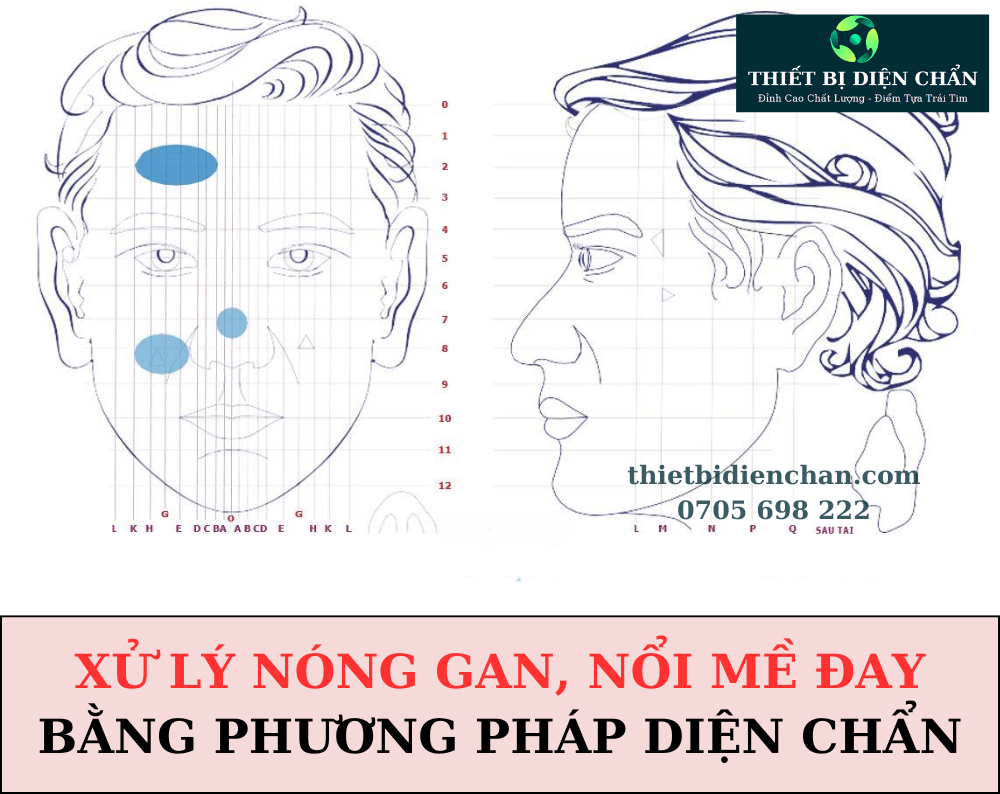 NÓNG GAN, NỔI MỀ ĐAY