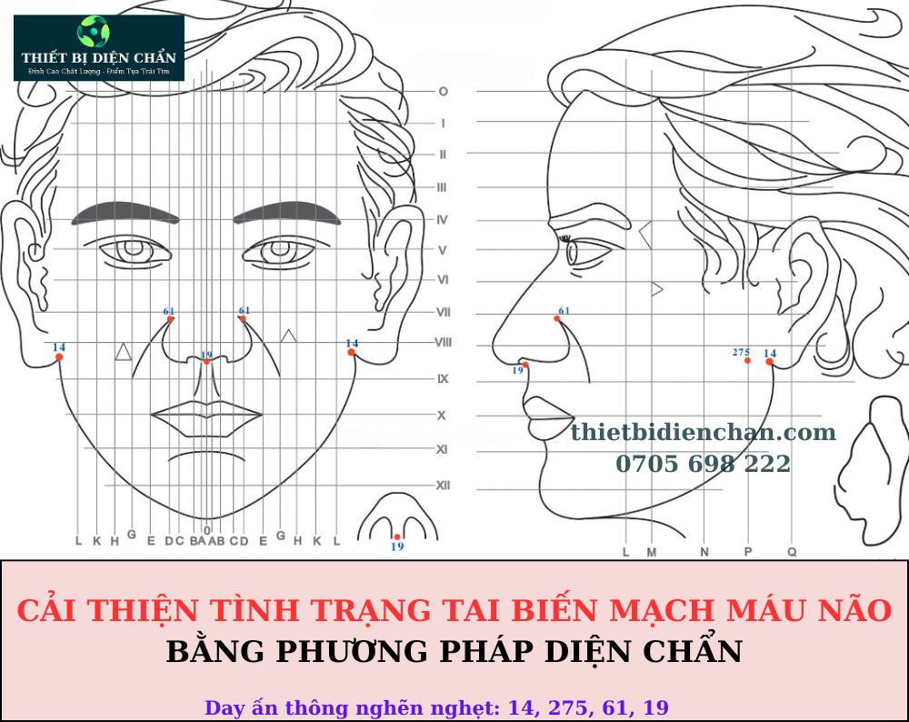 Tai biến mạch máu não