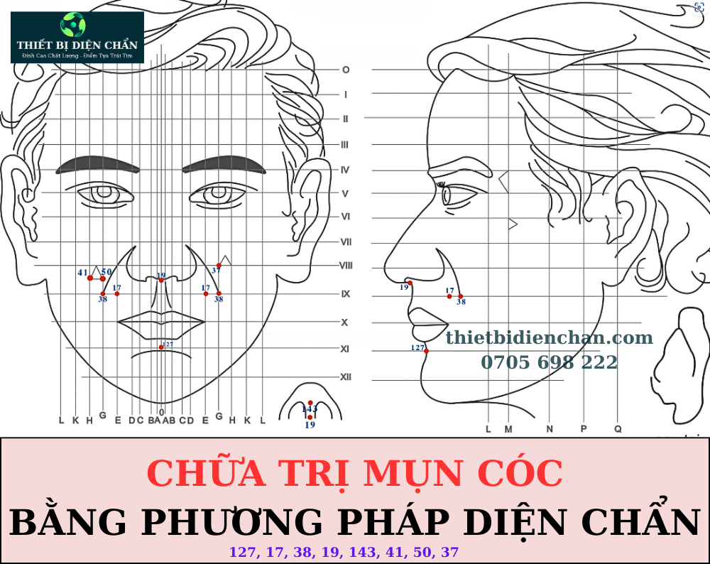 Mụn cóc