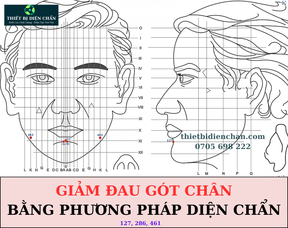 Đau gót chân