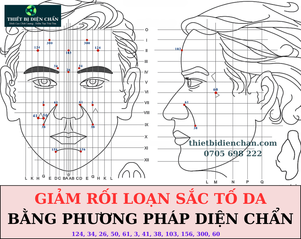 Rối loạn sắc tố da