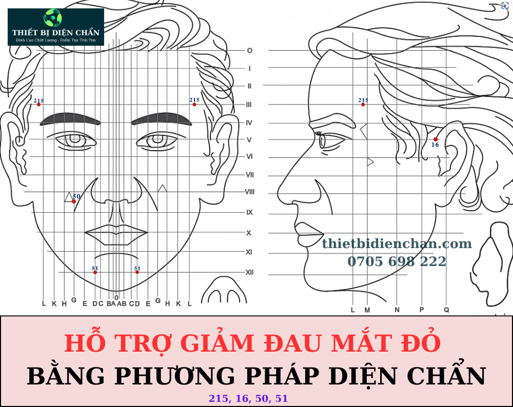 Đau mắt đỏ