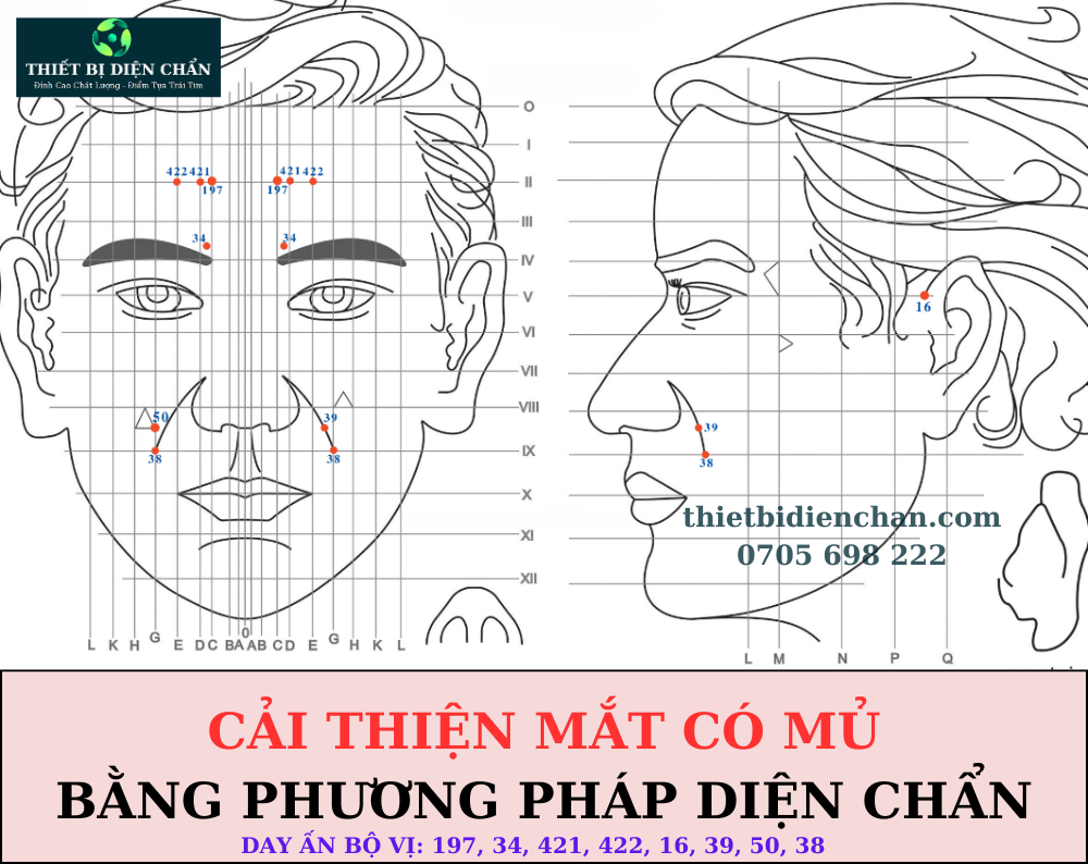 mắt có mủ