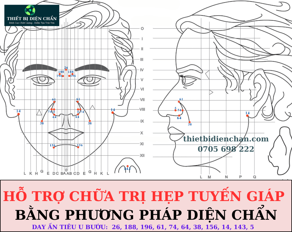 hẹp tuyến giáp