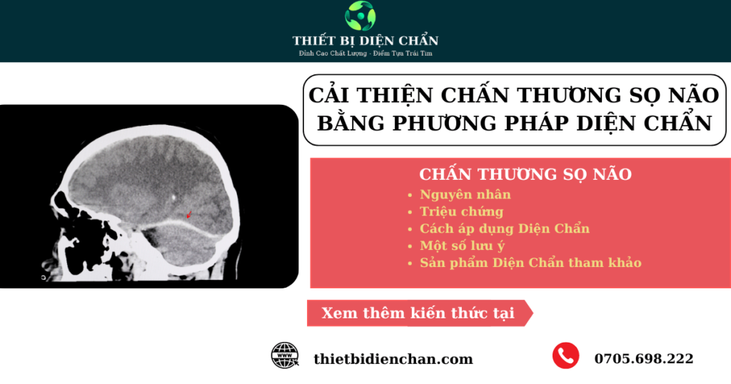 chấn thương sọ não