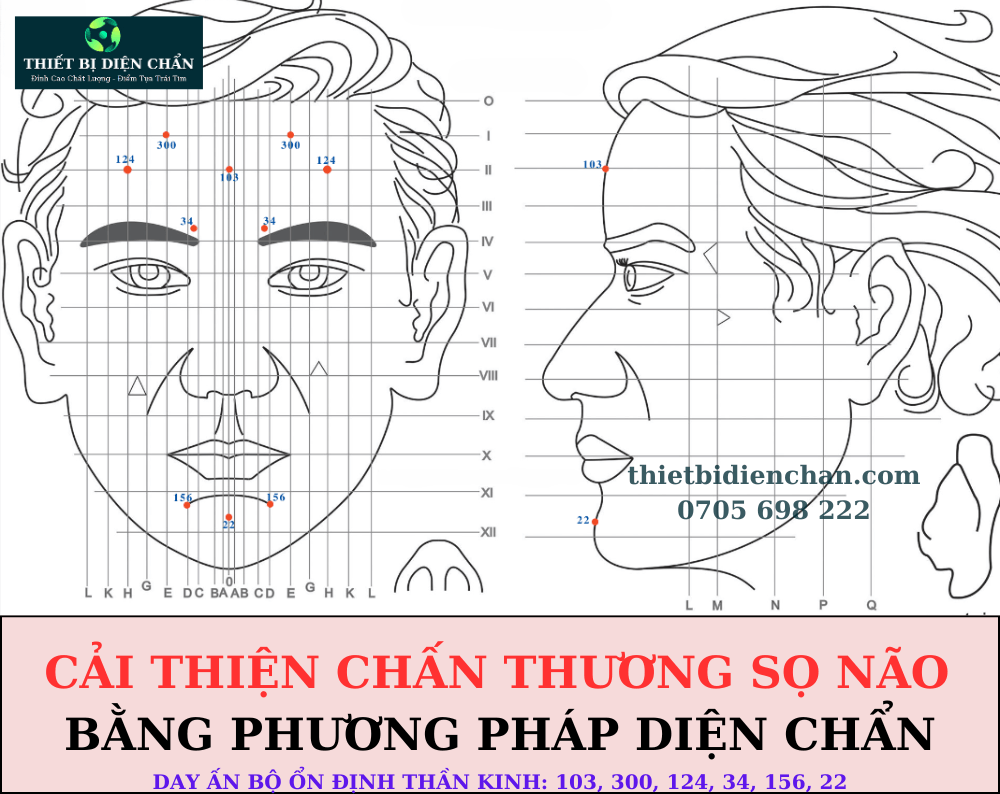chấn thương sọ não