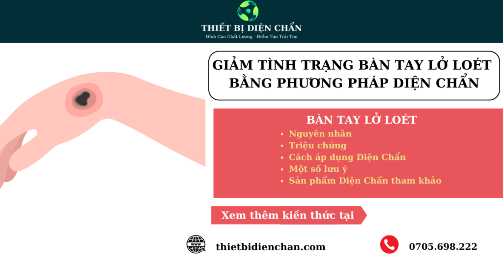 bàn tay lở loét