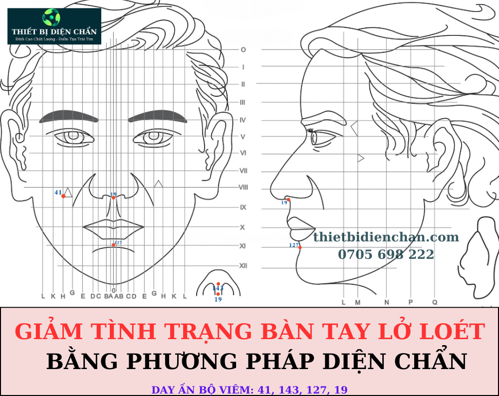 bàn tay lở loét
