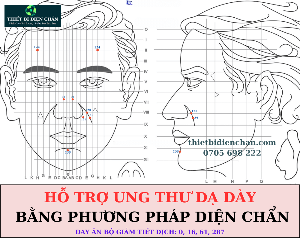 ung thư dạ dày