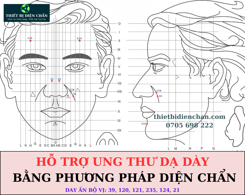 ung thư dạ dày