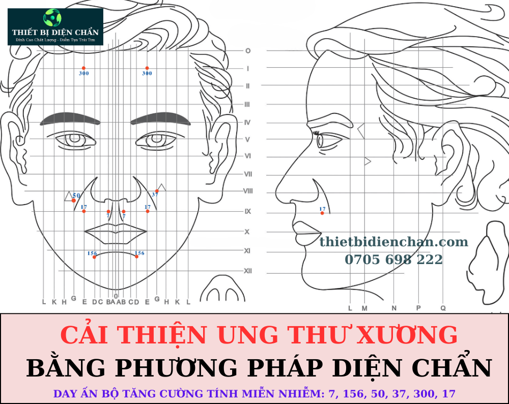 UNG THƯ XƯƠNG
