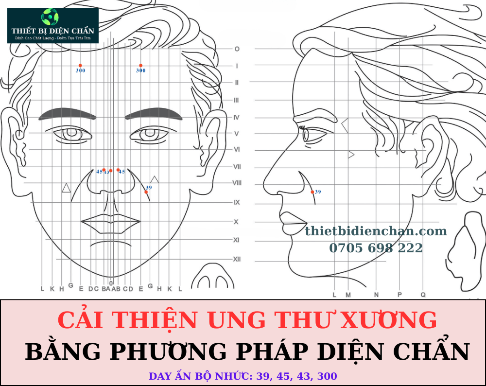 UNG THƯ XƯƠNG