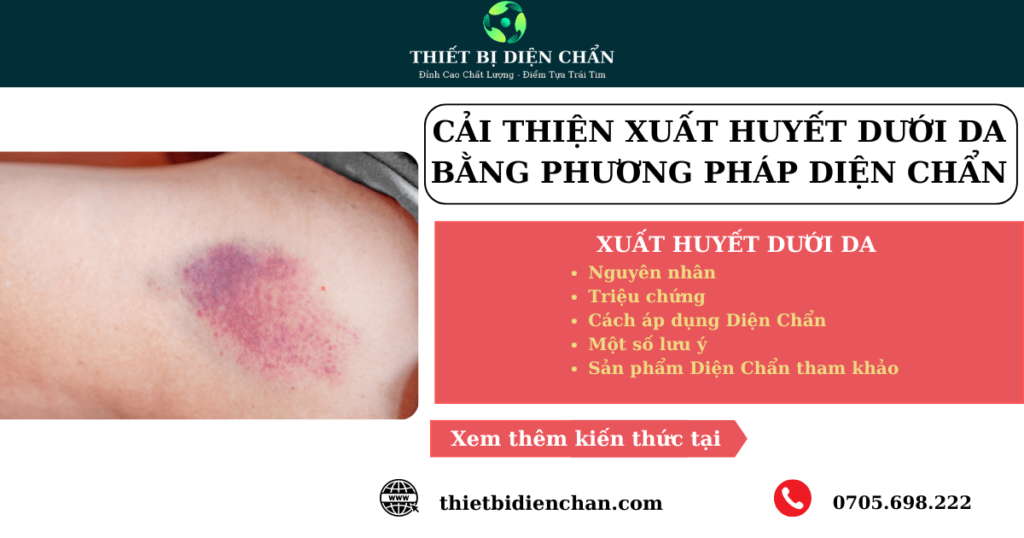 XUẤT HUYẾT DƯỚI DA