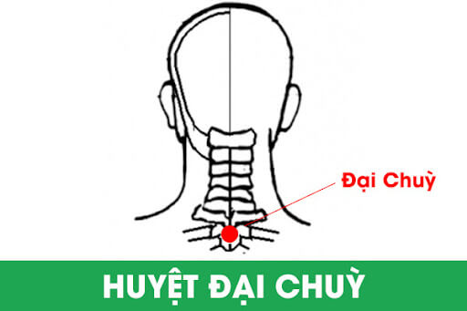 CẢI THIỆN BỆNH GOUT BẰNG PHƯƠNG PHÁP DIỆN CHẨN
