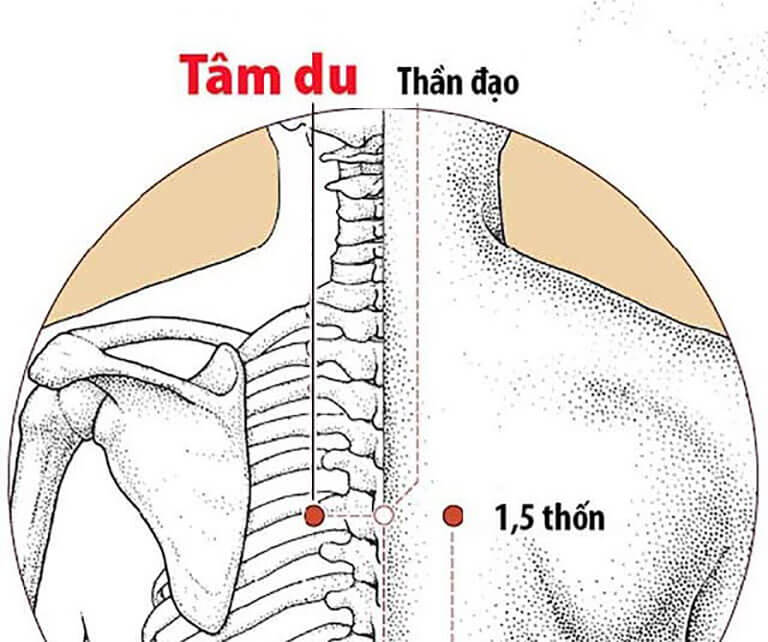 Nóng nhức tay chân