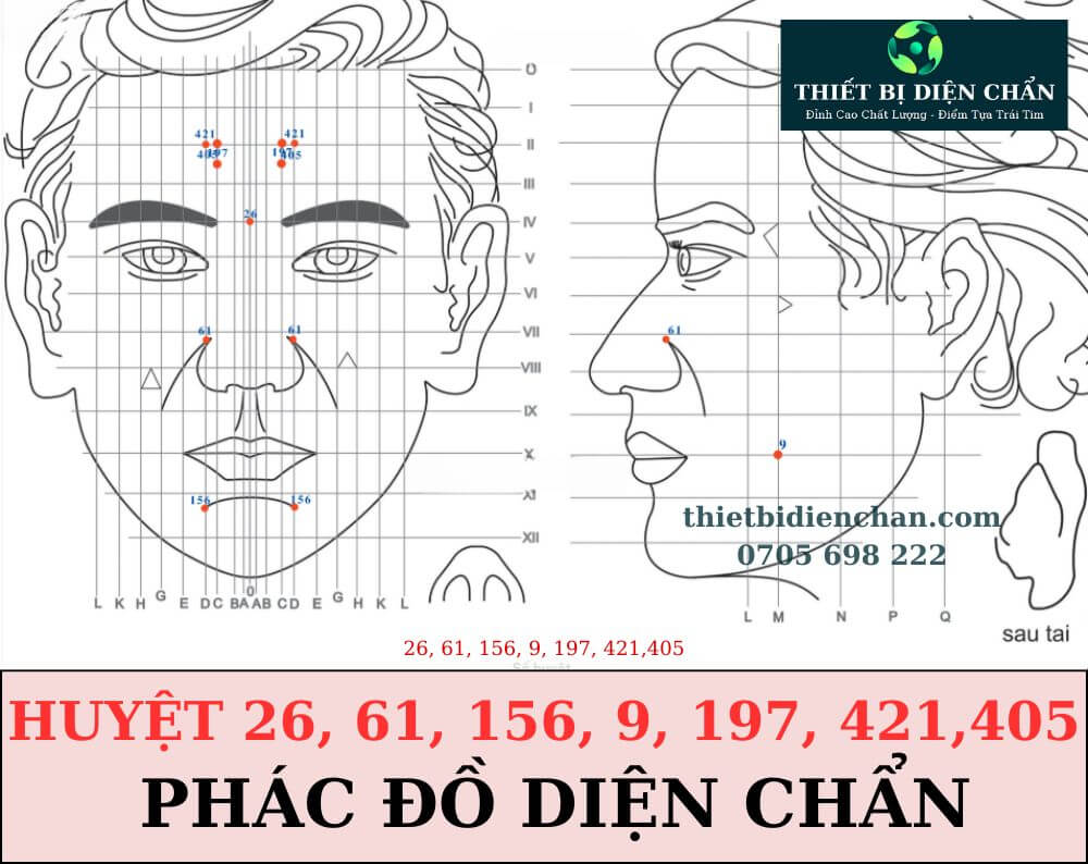 Huyệt 26, 61, 156, 9, 197, 421,405